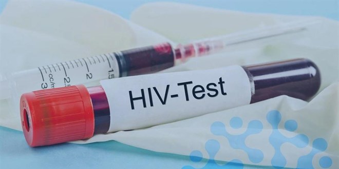 AIDS'ten len 13 yandaki ocuun babasnn ifadesi ortaya kt