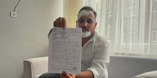 Taksi Şoförü Eski Sözlüsünün Sevgilisi Polislerce Dövüldü İddiası