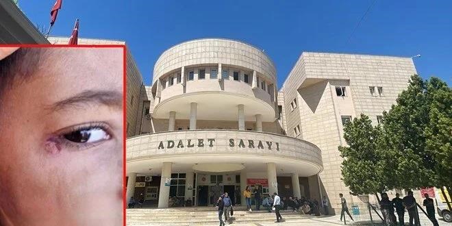İlkokul öğrencisinin yüzünde sigara söndüren temizlik görevlisi tutuklandı - Son Dakika Haber