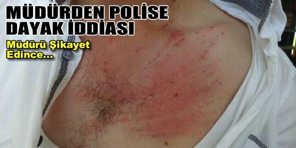 Polis memuru amirinden dayak yedim diye ikayetci oldu