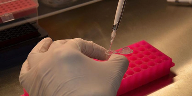 Trkiye'de 1,5 milyon kadna HPV-DNA taramas
