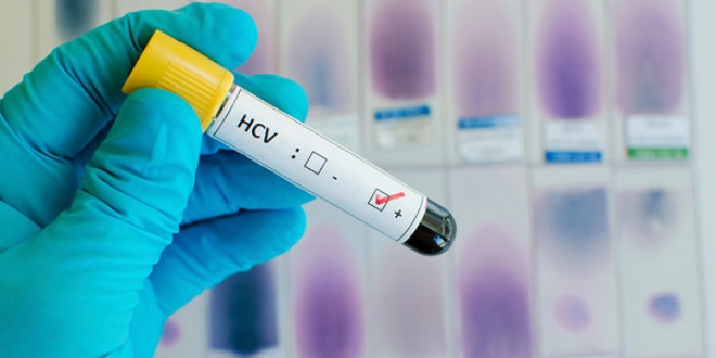 FDA, Hepatit C iin ilk ila kombinasyonunu onaylad