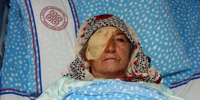 Erzurum'da katarakt ameliyat sonras enfeksiyon iddias