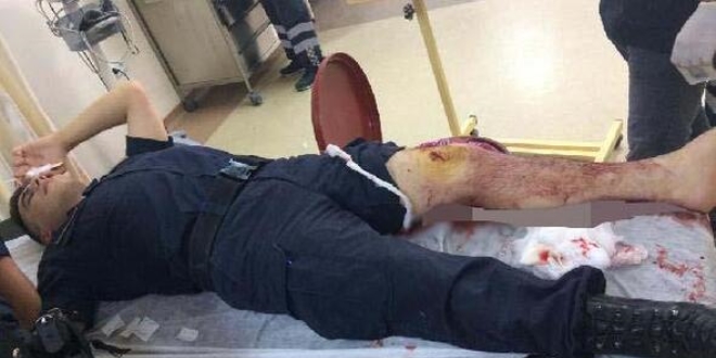 Hastanede kavgay ayrmak isteyen Jandarma yaraland