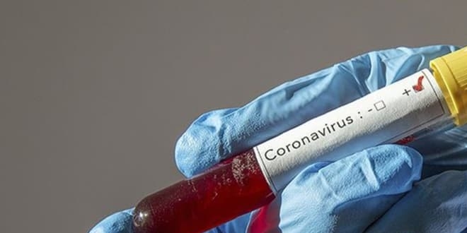 Koronavirs yenen 9 jandarma personelinden immn plazma ba