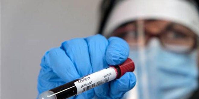 DS'den 'koronavirs testi' aklamas